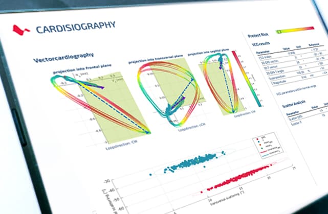 Tabletin ekranında bir Cardisiography raporu