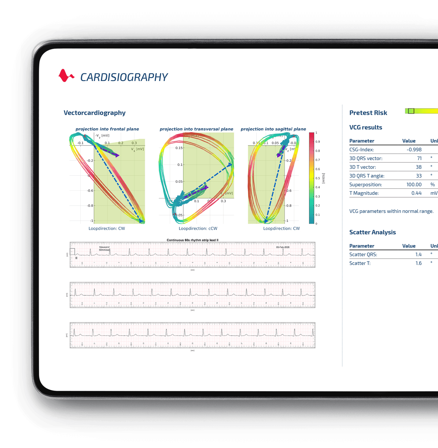 Tablette Cardisiography raporu: üç düzlemde vektör döngüleri, ritim şeritleri ve VCG sonuç tablosu